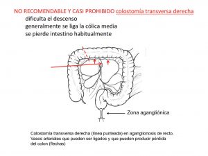 Prohibido colostomía transversa derecha